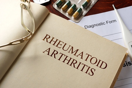 RHEUMATOID ARTHRITISの:書籍