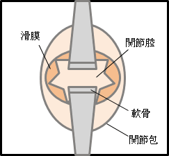 関節リウマチ ステージⅠ（初期～中期）